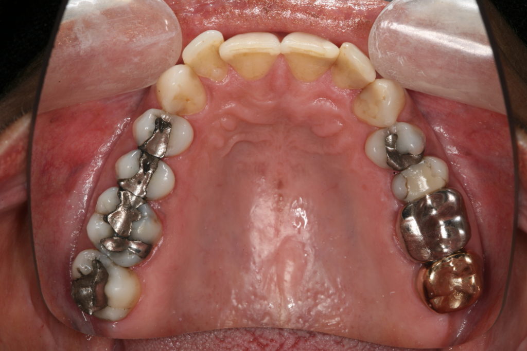 AXTELB_Galvanism_UpperArch-1024x683-1